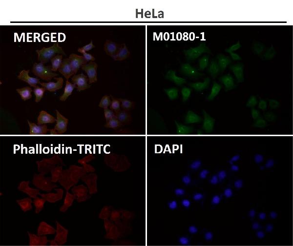 1 - Anti-CD63 Rabbit Monoclonal Antibody ABO13340