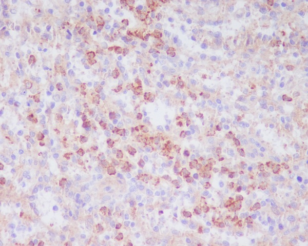 2 - Anti-CD63 Rabbit Monoclonal Antibody ABO13340
