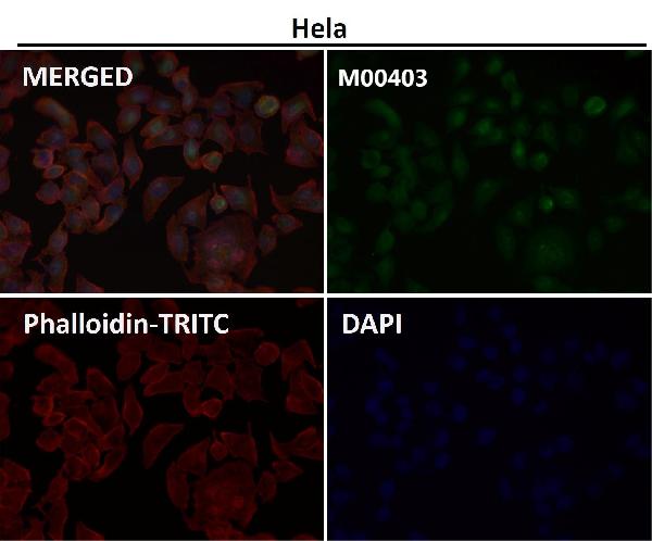 1 - Anti-NOX4 Rabbit Monoclonal Antibody ABO13341
