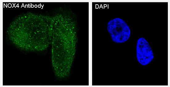 3 - Anti-NOX4 Rabbit Monoclonal Antibody ABO13341