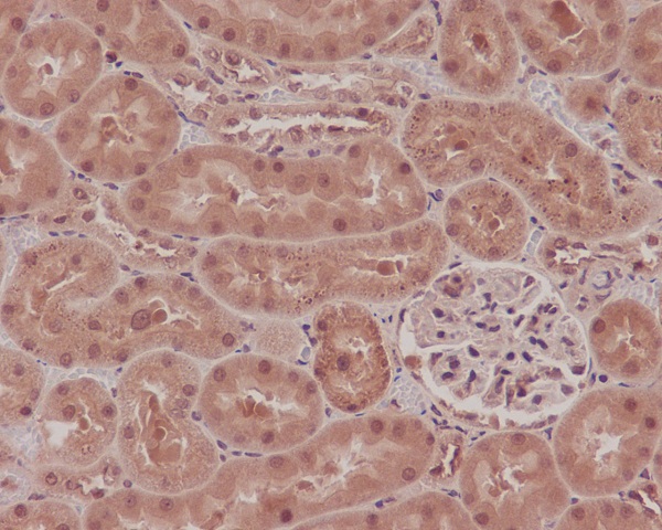 2 - Anti-NOX4 Rabbit Monoclonal Antibody ABO13341