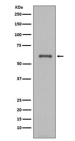 1 - Anti-NOX4 Rabbit Monoclonal Antibody ABO13341