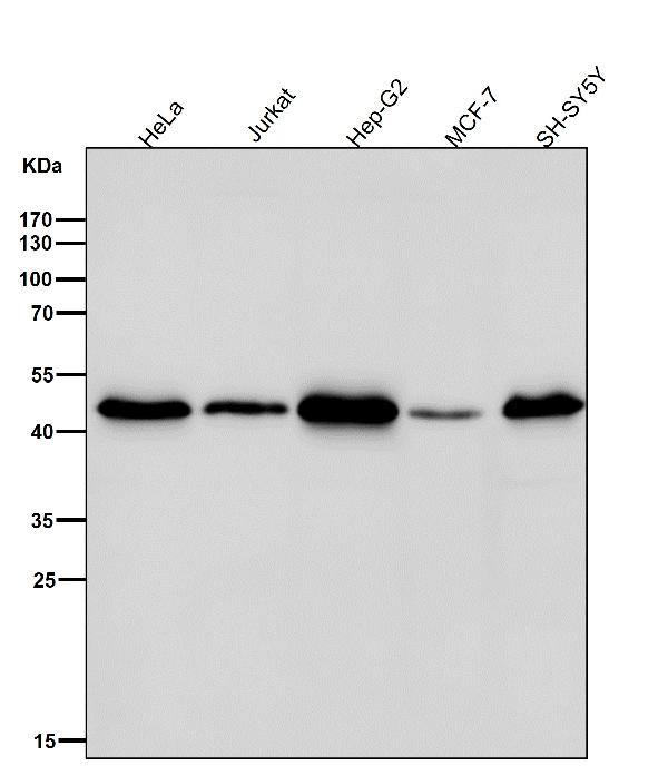 1 - Anti-VASP Rabbit Monoclonal Antibody ABO13342