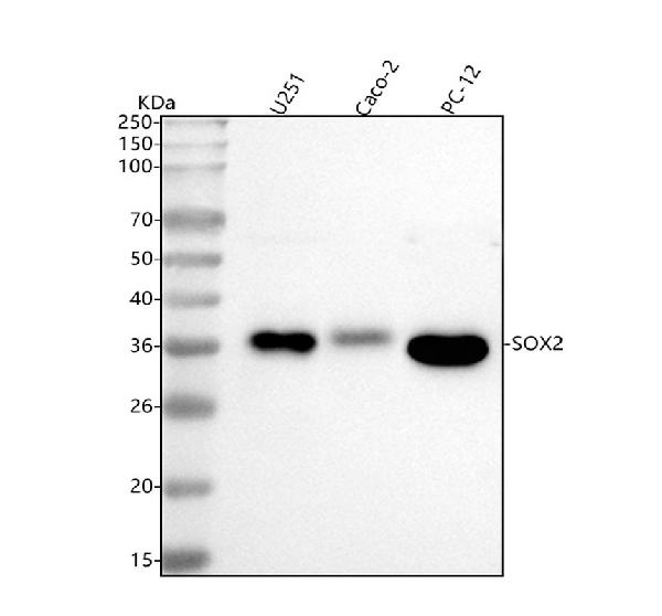 1 - Anti-SOX2 Rabbit Monoclonal Antibody ABO13343
