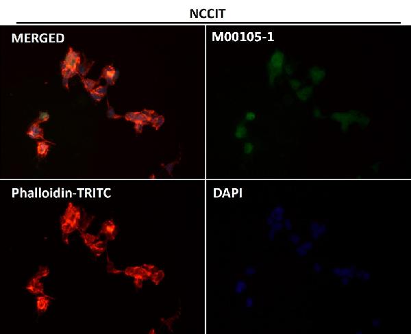 1 - Anti-SOX2 Rabbit Monoclonal Antibody ABO13343