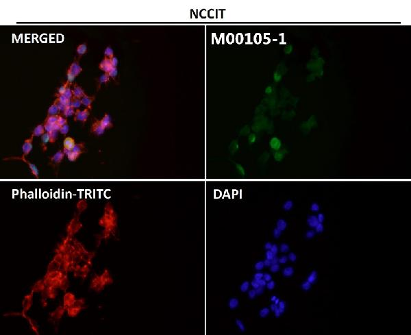 1 - Anti-SOX2 Rabbit Monoclonal Antibody ABO13343