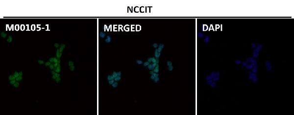 1 - Anti-SOX2 Rabbit Monoclonal Antibody ABO13343