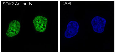 3 - Anti-SOX2 Rabbit Monoclonal Antibody ABO13343
