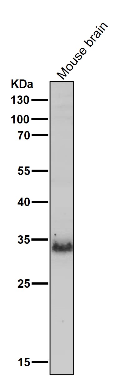 1 - Anti-SOX2 Rabbit Monoclonal Antibody ABO13343