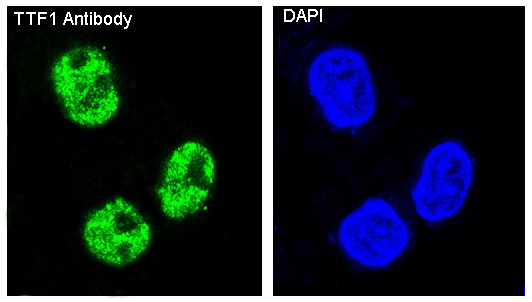 3 - Anti-TTF1 NKX2-1 Rabbit Monoclonal Antibody ABO13344