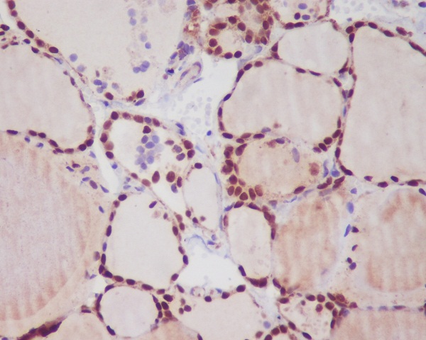2 - Anti-TTF1 NKX2-1 Rabbit Monoclonal Antibody ABO13344