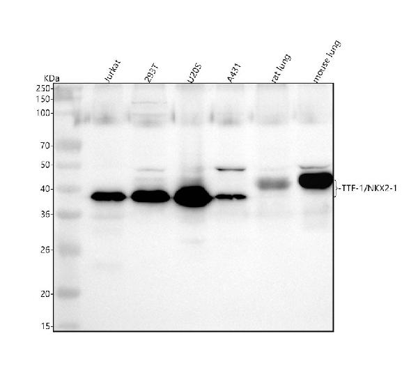1 - Anti-TTF1 NKX2-1 Rabbit Monoclonal Antibody ABO13344
