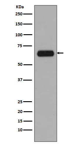 1 - Anti-TCF3 TCF7L1 Rabbit Monoclonal Antibody ABO13346