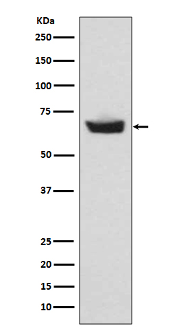1 - Anti-CETP Rabbit Monoclonal Antibody ABO13348