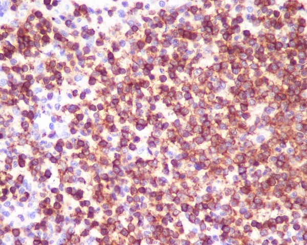 2 - Anti-CD45 PTPRC Rabbit Monoclonal Antibody ABO13351