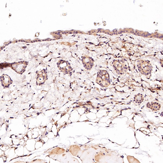 2 - Anti-CD45 PTPRC Rabbit Monoclonal Antibody ABO13351