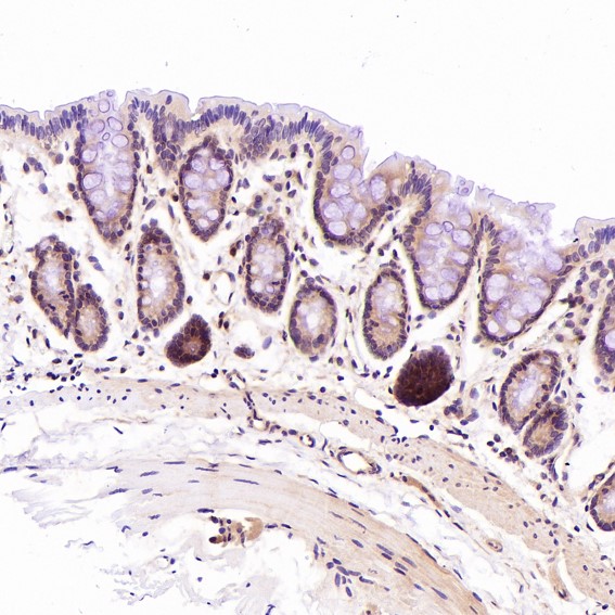 2 - Anti-CD45 PTPRC Rabbit Monoclonal Antibody ABO13351