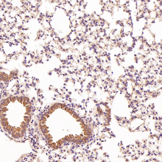 2 - Anti-CD45 PTPRC Rabbit Monoclonal Antibody ABO13351