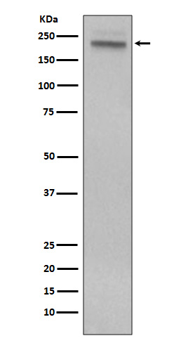 1 - Anti-CD45 PTPRC Rabbit Monoclonal Antibody ABO13351