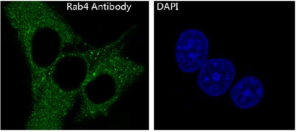 3 - Anti-Rab4 RAB4A Rabbit Monoclonal Antibody ABO13352