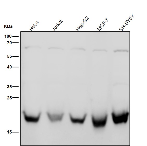 1 - Anti-Rab4 RAB4A Rabbit Monoclonal Antibody ABO13352