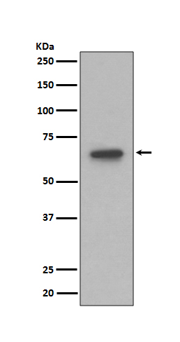 1 - Anti-S6K1 RPS6KB1 Rabbit Monoclonal Antibody ABO13353
