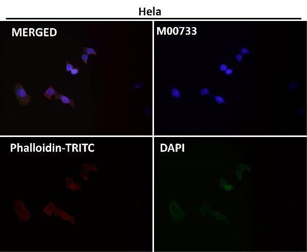 1 - Anti-MMP1 Rabbit Monoclonal Antibody ABO13354