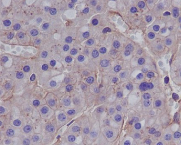 2 - Anti-MMP1 Rabbit Monoclonal Antibody ABO13354