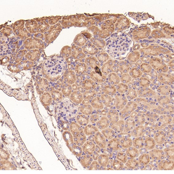 2 - Anti-MMP1 Rabbit Monoclonal Antibody ABO13354