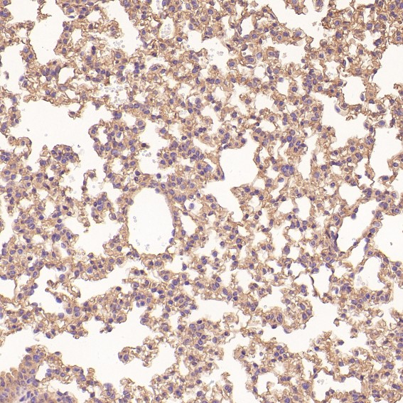 2 - Anti-MMP1 Rabbit Monoclonal Antibody ABO13354