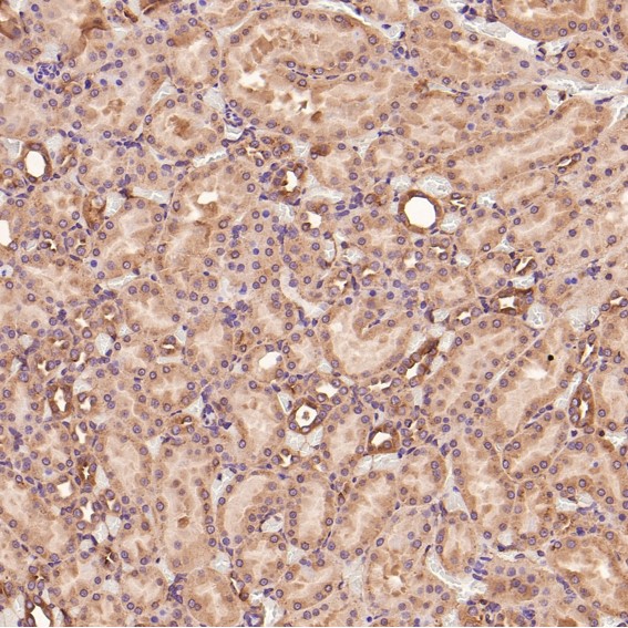 2 - Anti-MMP1 Rabbit Monoclonal Antibody ABO13354
