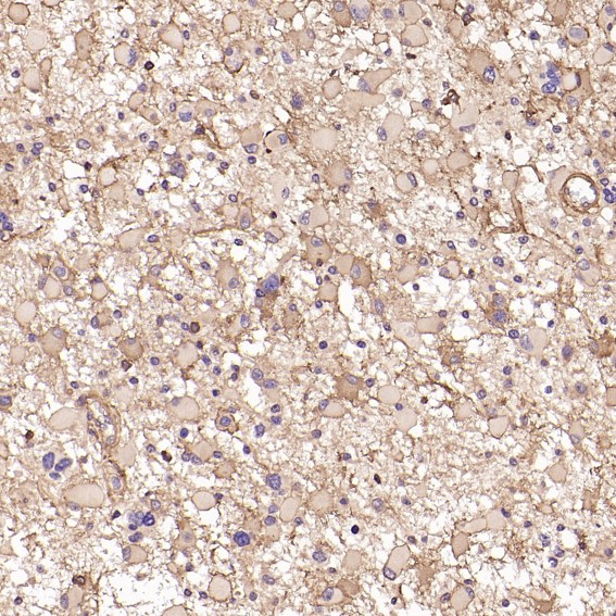 2 - Anti-MMP1 Rabbit Monoclonal Antibody ABO13354