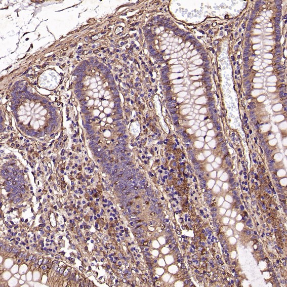 2 - Anti-MMP1 Rabbit Monoclonal Antibody ABO13354