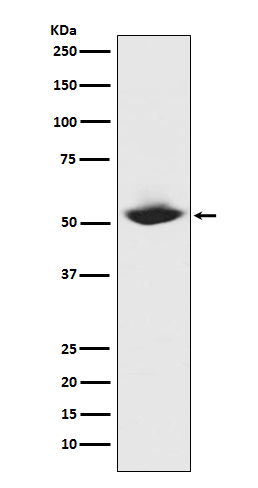1 - Anti-MMP1 Rabbit Monoclonal Antibody ABO13354
