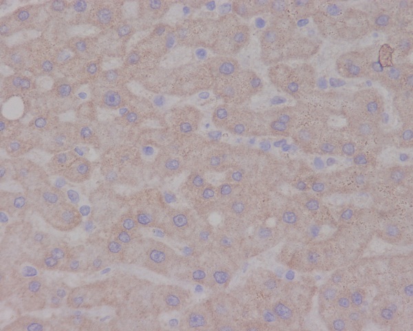 2 - Anti-TrkA NTRK1 Rabbit Monoclonal Antibody ABO13355