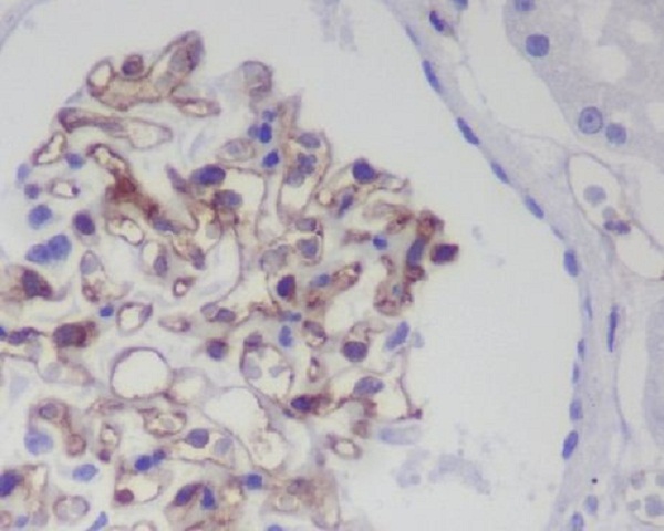 2 - Anti-CD31 PECAM1 Rabbit Monoclonal Antibody ABO13356