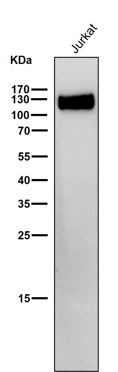 1 - Anti-CD31 PECAM1 Rabbit Monoclonal Antibody ABO13356