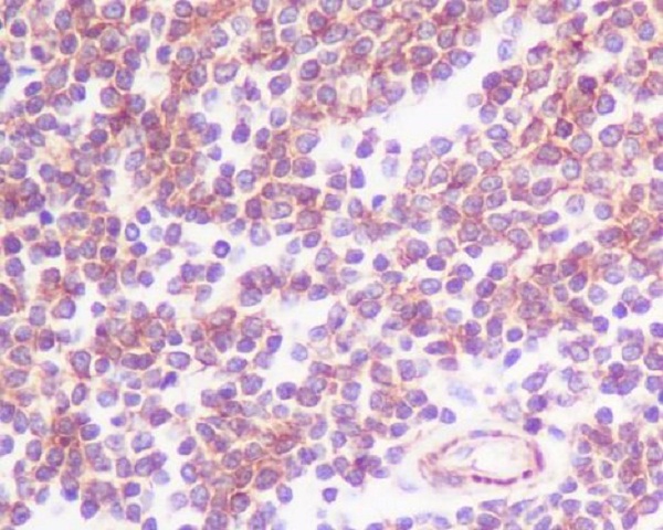 2 - Anti-CCR7 Rabbit Monoclonal Antibody ABO13357