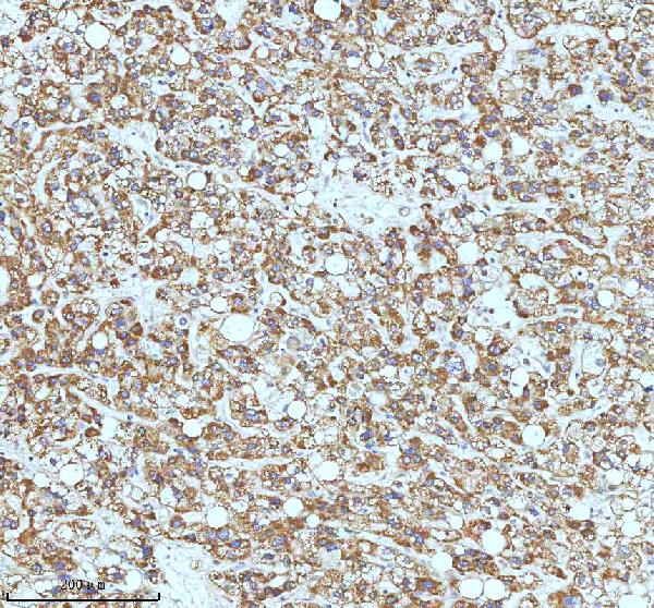 2 - Anti-ASK1 MAP3K5 Rabbit Monoclonal Antibody ABO13358