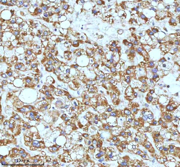 2 - Anti-ASK1 MAP3K5 Rabbit Monoclonal Antibody ABO13358