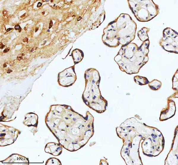 2 - Anti-ASK1 MAP3K5 Rabbit Monoclonal Antibody ABO13358
