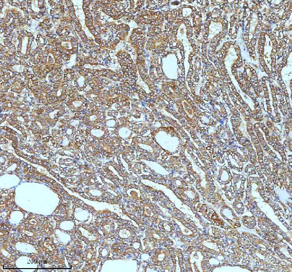 2 - Anti-ASK1 MAP3K5 Rabbit Monoclonal Antibody ABO13358