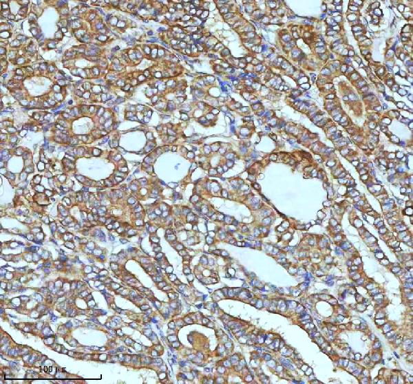 2 - Anti-ASK1 MAP3K5 Rabbit Monoclonal Antibody ABO13358