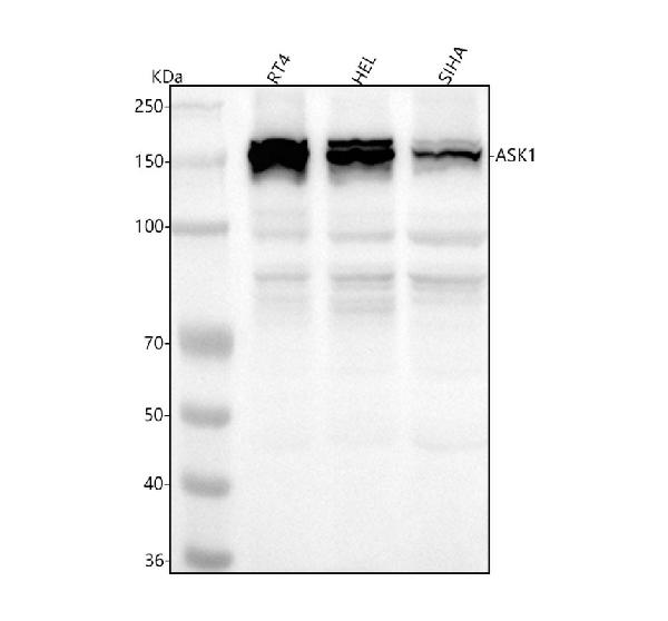 1 - Anti-ASK1 MAP3K5 Rabbit Monoclonal Antibody ABO13358