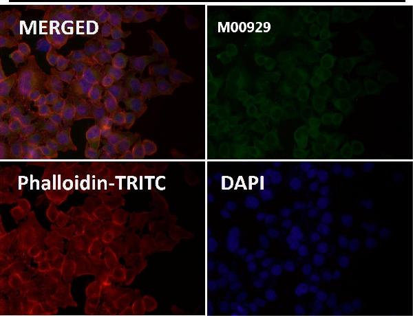 1 - Anti-ASK1 MAP3K5 Rabbit Monoclonal Antibody ABO13358