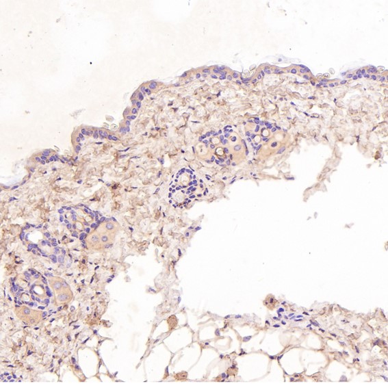 2 - Anti-ASK1 MAP3K5 Rabbit Monoclonal Antibody ABO13358