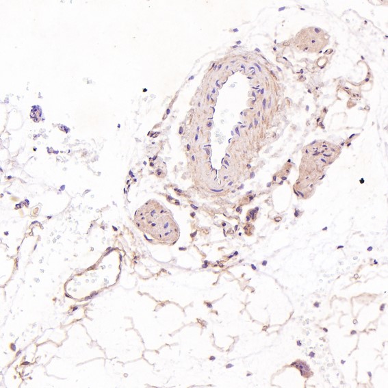 2 - Anti-ASK1 MAP3K5 Rabbit Monoclonal Antibody ABO13358