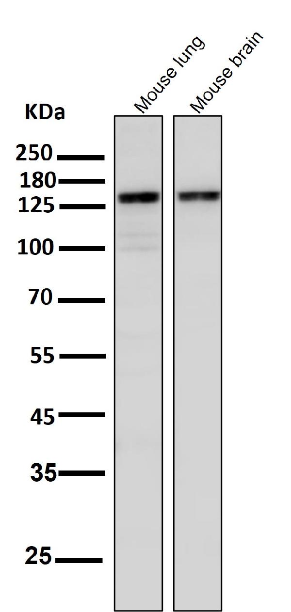 1 - Anti-ASK1 MAP3K5 Rabbit Monoclonal Antibody ABO13358