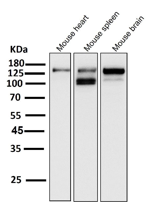 1 - Anti-ASK1 MAP3K5 Rabbit Monoclonal Antibody ABO13358