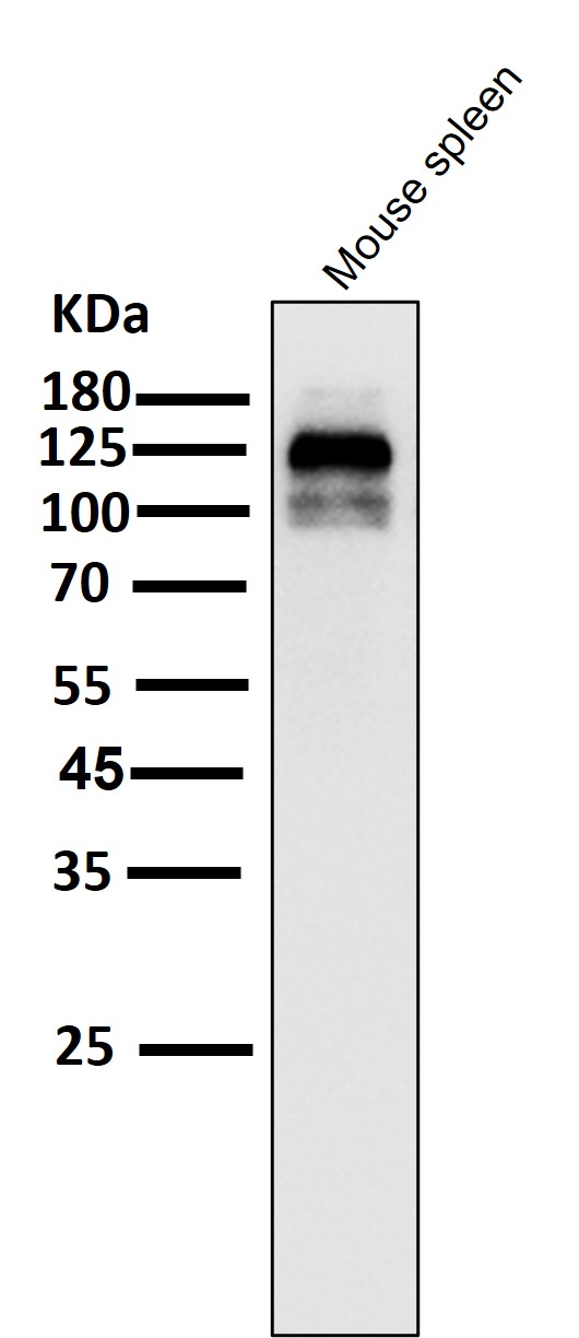 1 - Anti-ASK1 MAP3K5 Rabbit Monoclonal Antibody ABO13358